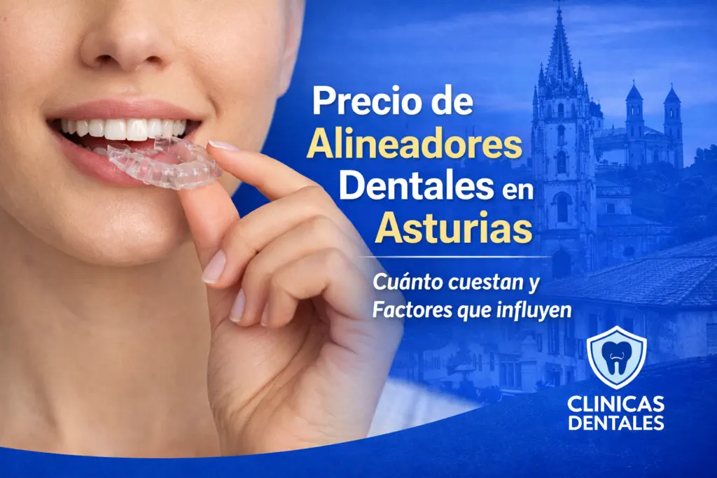 Precio de Alineadores Dentales en Asturias