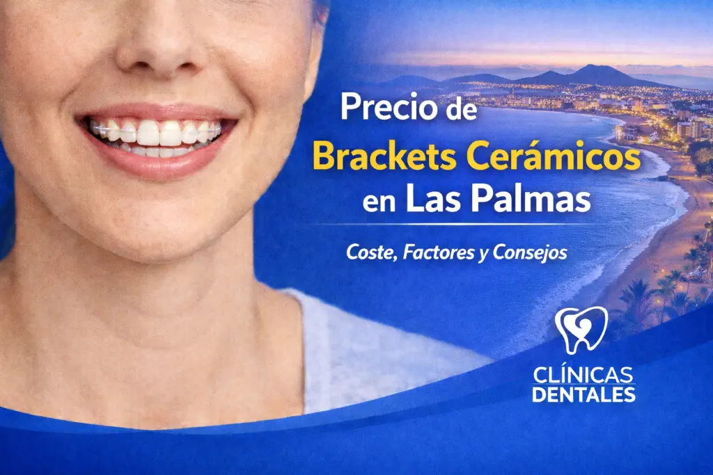 precio brackets cerámicos Las Palmas