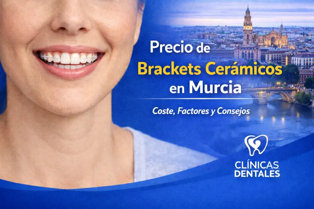 precio brackets cerámicos Murcia
