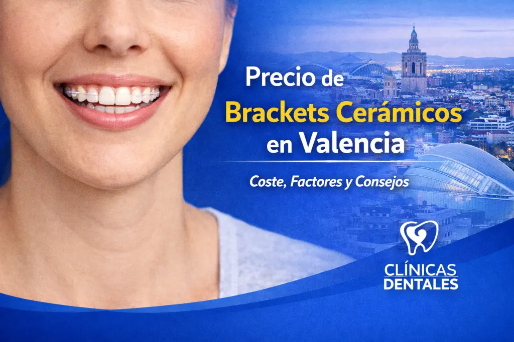 precio brackets cerámicos Valencia