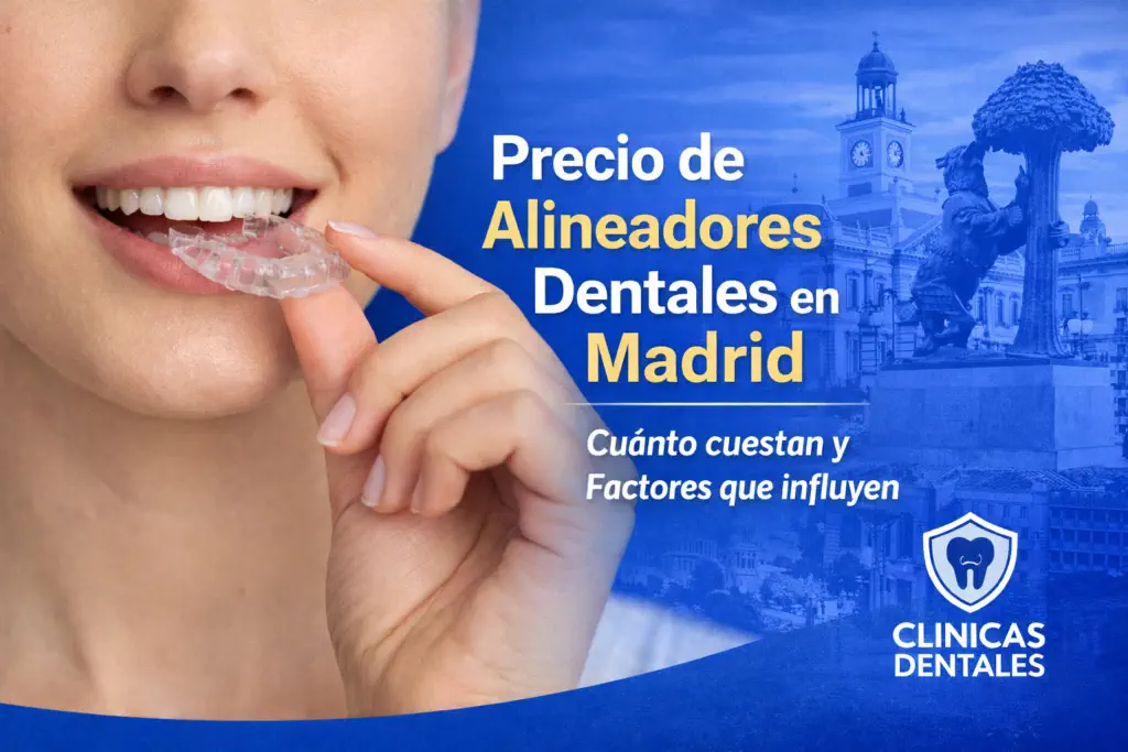 precio de alineadores dentales en Madrid