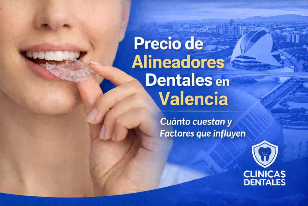 precio de alineadores dentales en Valencia