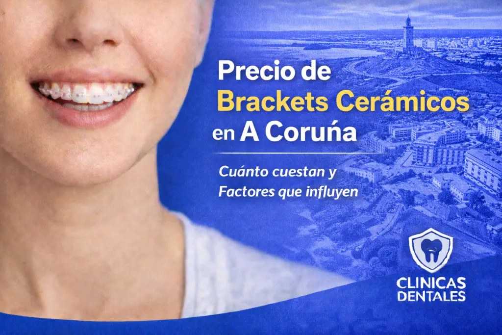 precio de brackets cerámicos en A Coruña