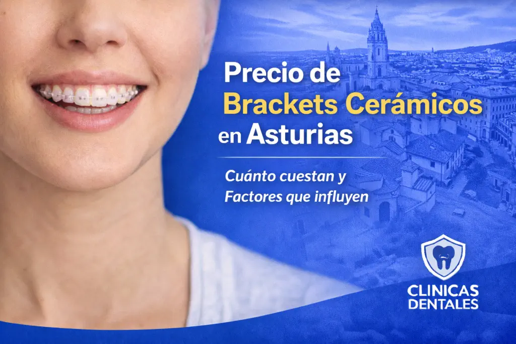 precio de brackets cerámicos en Asturias
