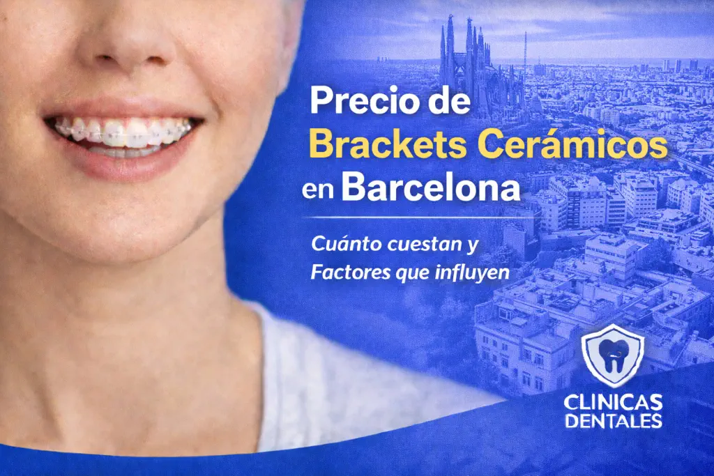 precio de brackets cerámicos en Barcelona
