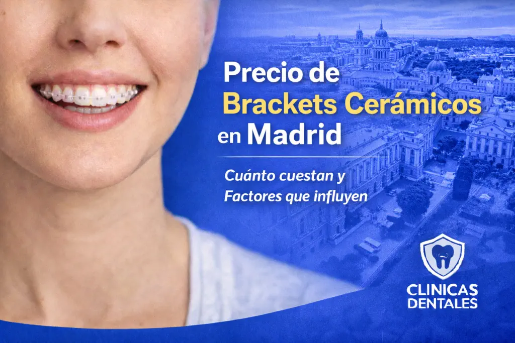 precio de brackets cerámicos en Madrid