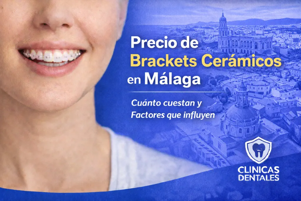precio de brackets cerámicos en Málaga