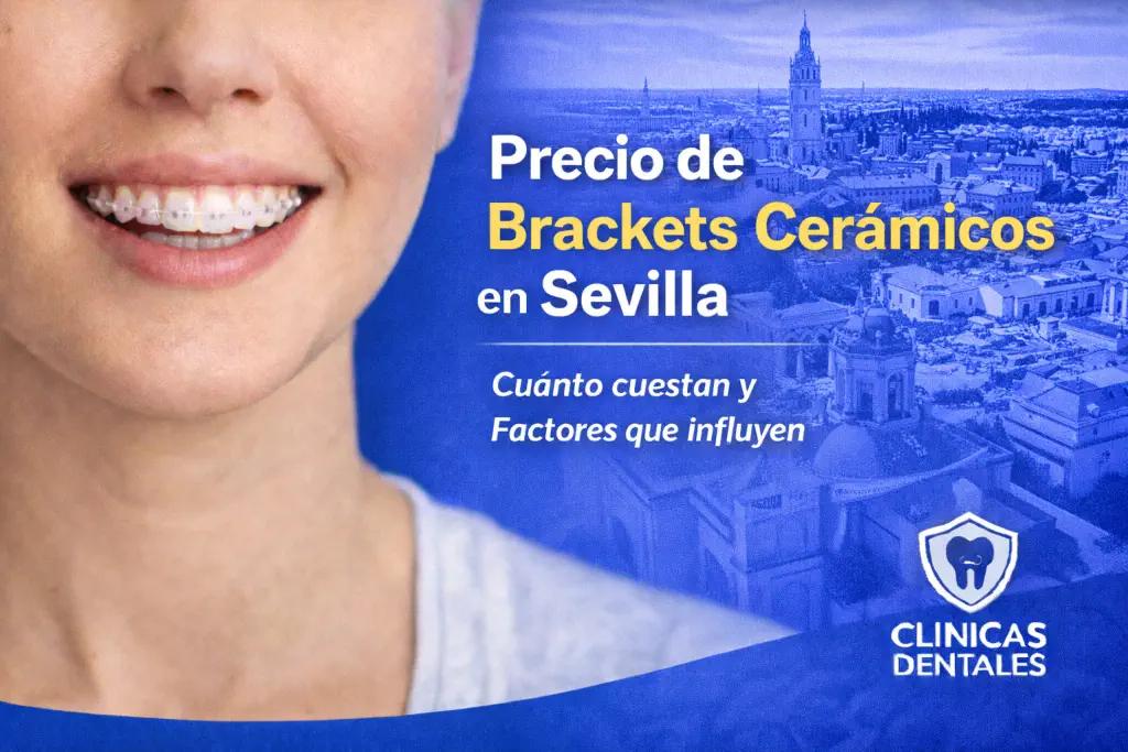 precio de brackets cerámicos en Sevilla