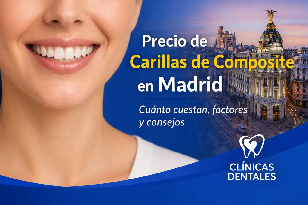 precio de carillas de composite en Madrid