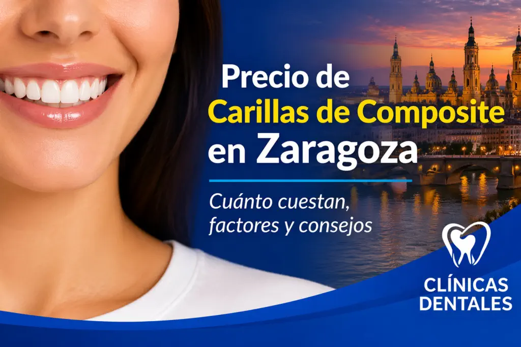 precio de carillas de composite en Zaragoza