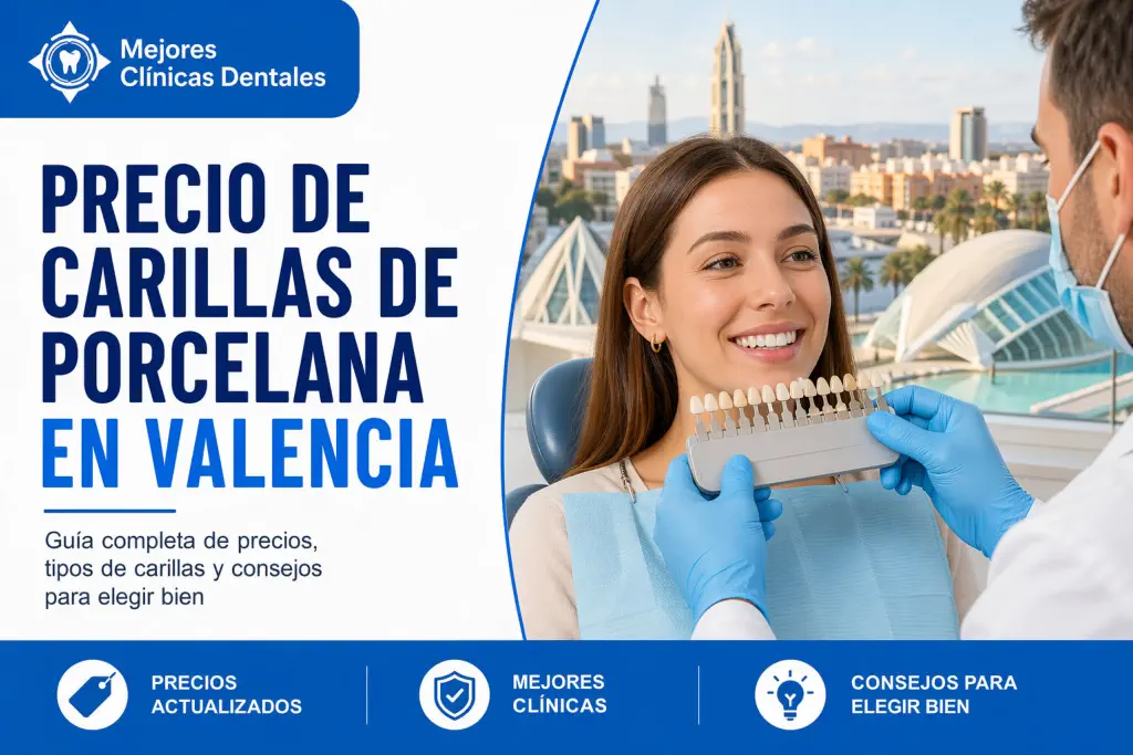 precio de carillas de porcelana en Valencia