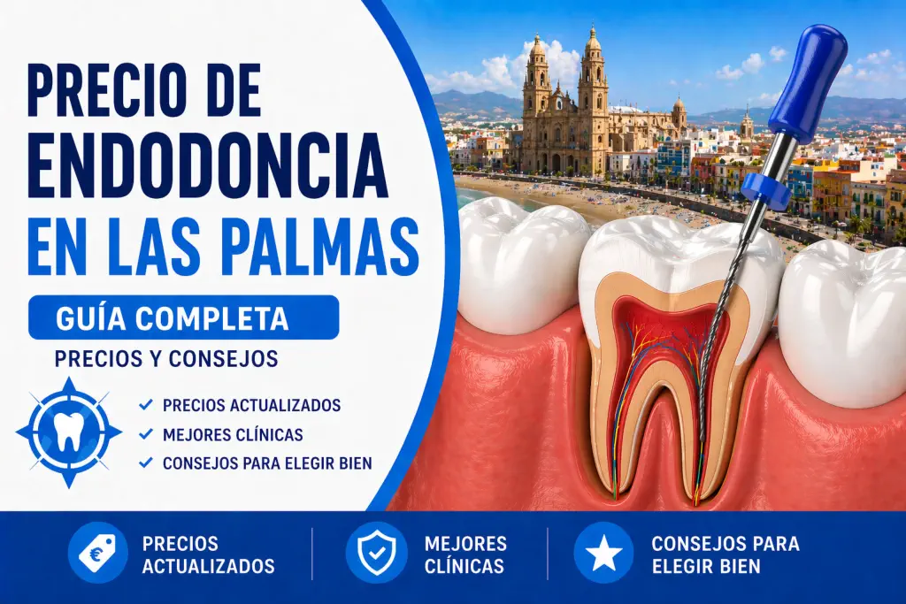 precio endodoncia las palmas