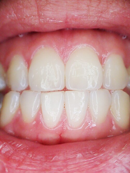 Primer plano de dientes en contacto para explicar la oclusión dental y la mordida
