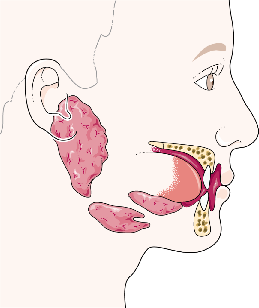 Ilustración anatómica de glándulas salivales relacionadas con la xerostomía y la boca seca