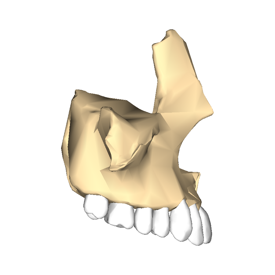 Anatomía del maxilar superior con dientes superiores en vista lateral