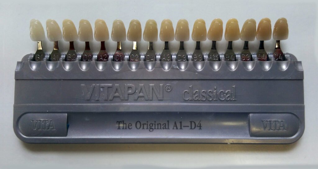 Guía de color dental utilizada para valorar el tono antes de un blanqueamiento dental